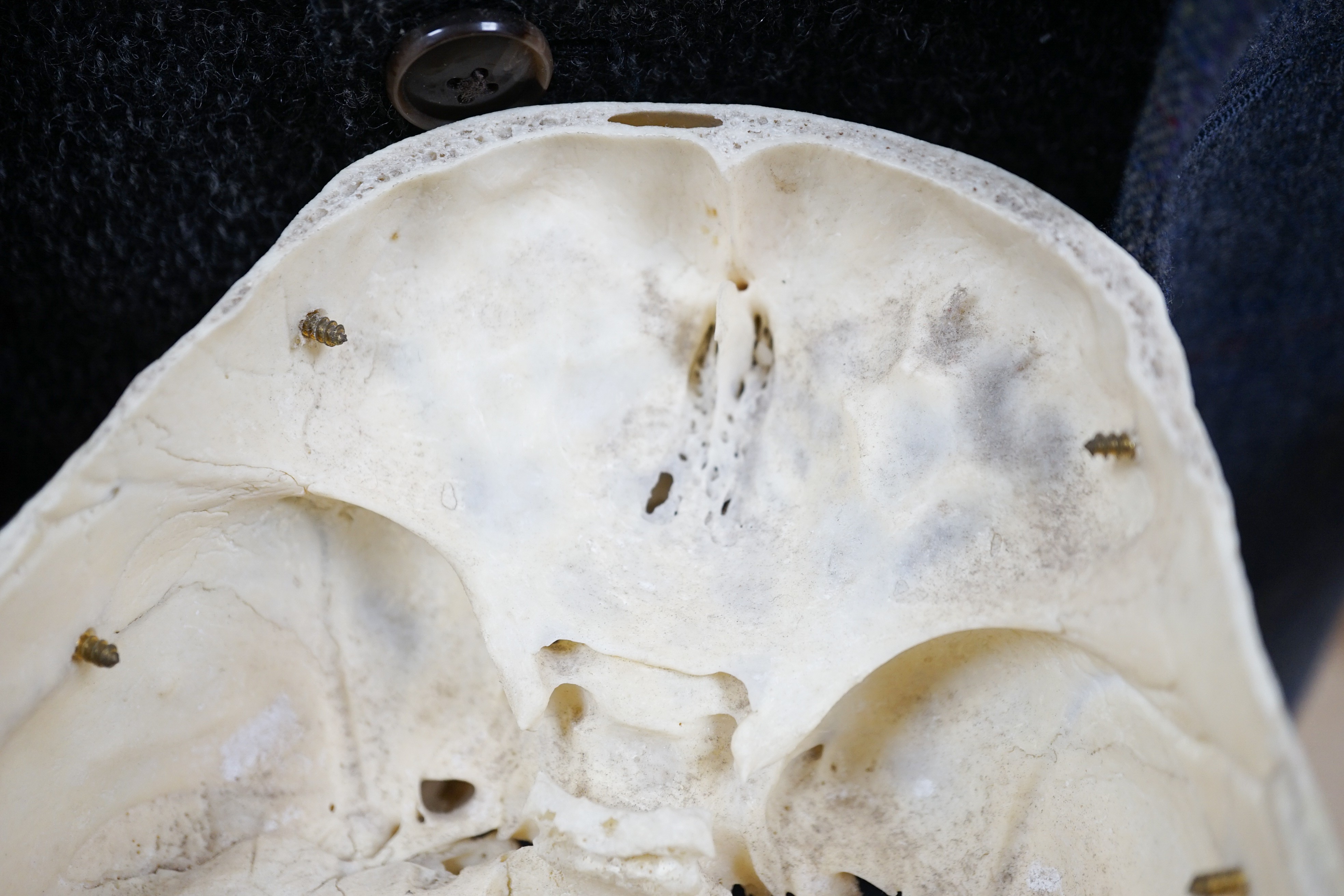 A human skull with removable cranium and spring loaded jaw 15.5cm